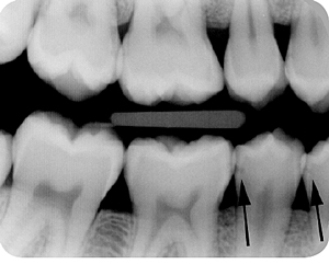 roentgen_3