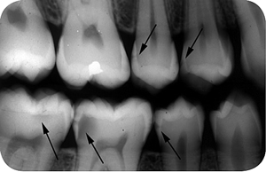 roentgen_4