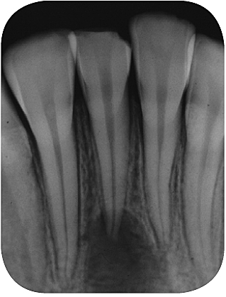 roentgen_5