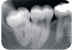 roentgen_6