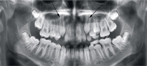 roentgen_7