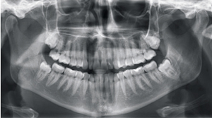 roentgen_8