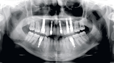 roentgen_9